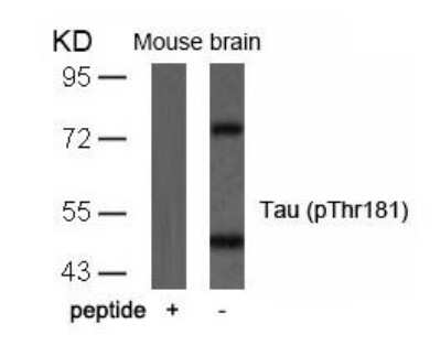 Western Blot: Tau [p Thr181] Antibody [NB100-82245]